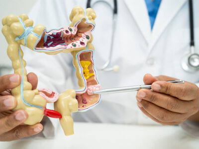 Fundamentos Anatómicos y Fisiológicos del Digestivo y del Sistema Urinario para TES