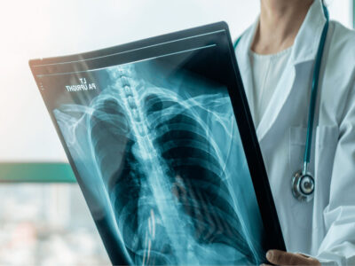 Localización de Estructuras Anatómicas para TCAE