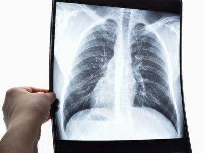 Fundamentos Anatómicos y Fisiológicos del Aparato Circulatorio y Respiratorio para TSID