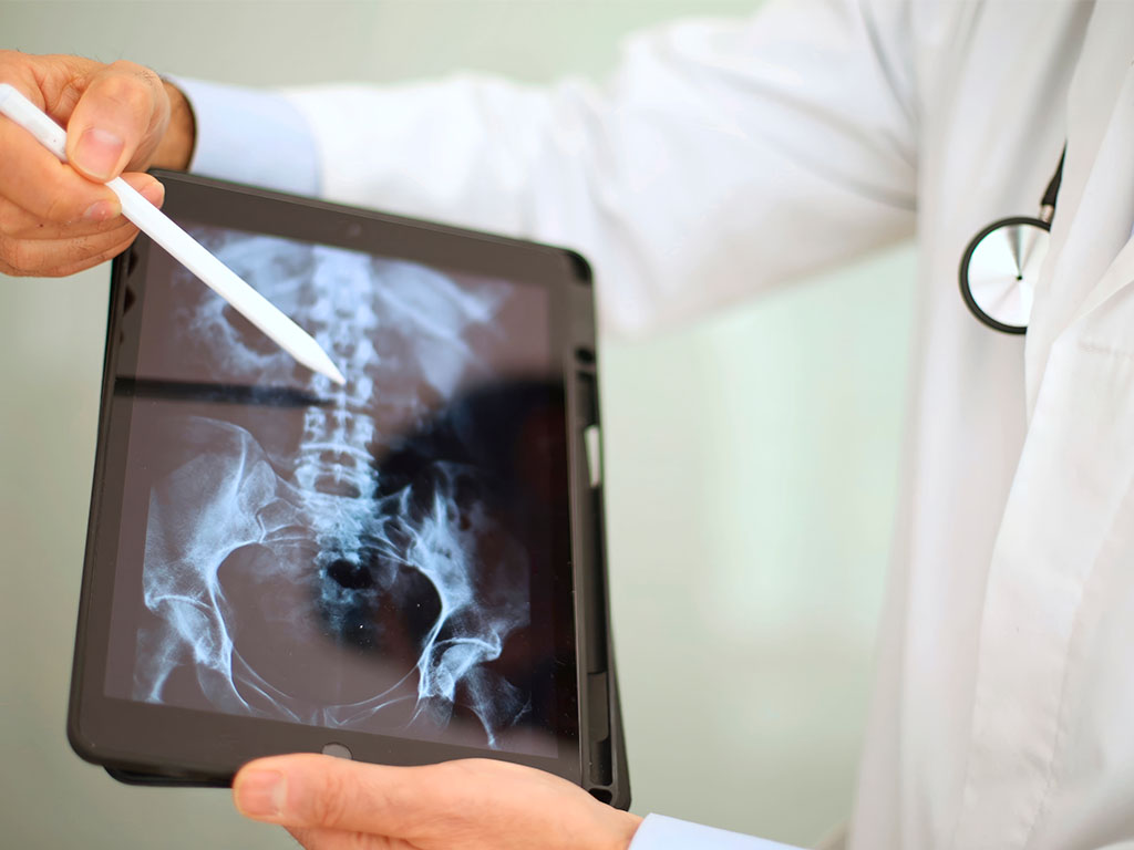 Fundamentos Anatómicos y Fisiológicos del Aparato Locomotor para TSID