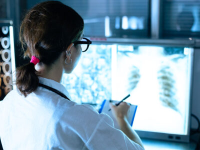 Localización de Estructuras Anatómicas para TSID